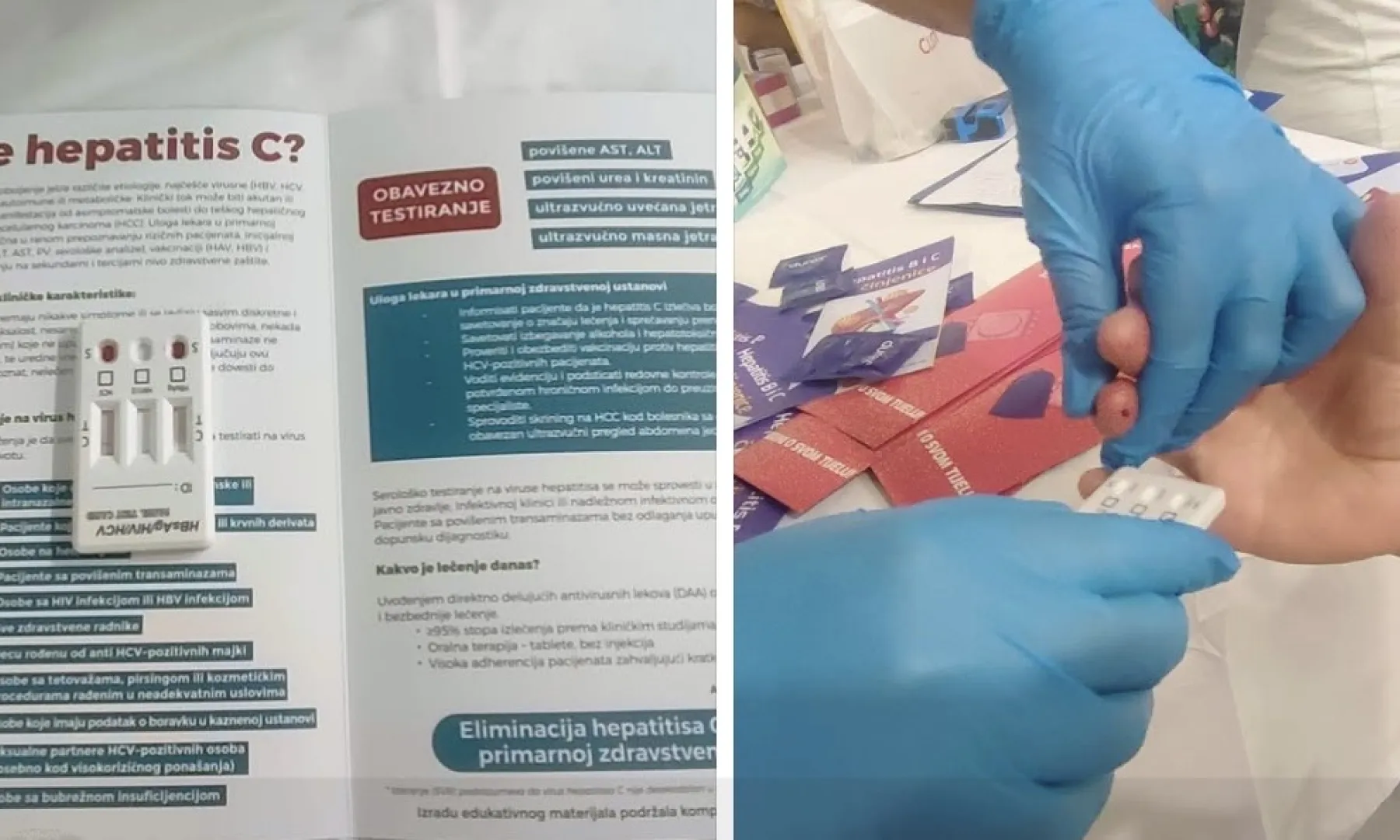 Besplatno testiranje na hepatitis B i C organizovano u Bihaću povodom Svjetskog dana hepatitisa