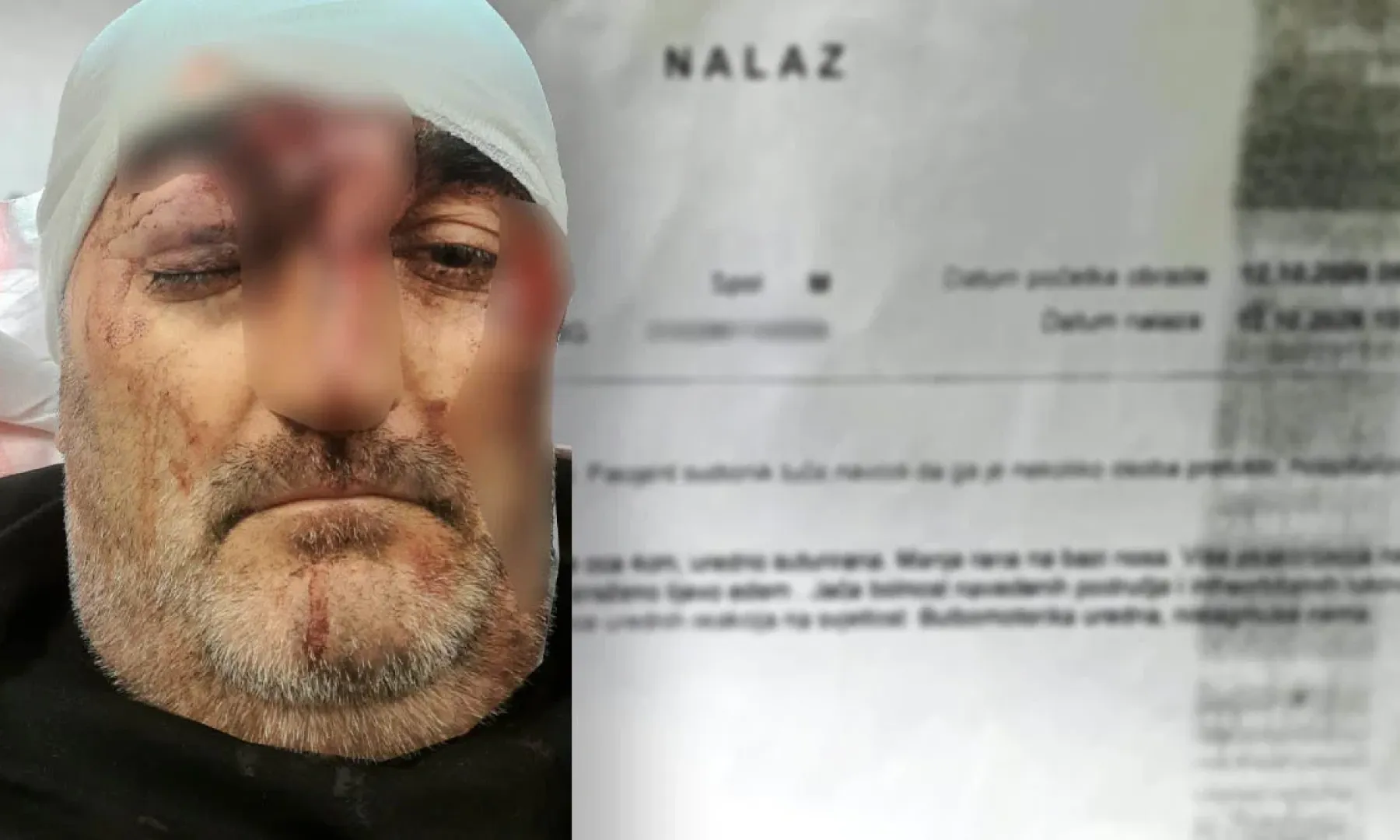Marko Luburić prijavio napad nakon lovačkog druženja u Kosmaju, završio na Centru urgentne medicine sa povredama