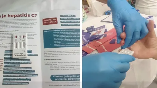 Besplatno testiranje na hepatitis B i C organizovano u Bihaću povodom Svjetskog dana hepatitisa