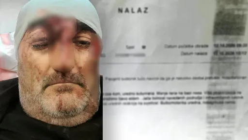 Marko Luburić prijavio napad nakon lovačkog druženja u Kosmaju, završio na Centru urgentne medicine sa povredama
